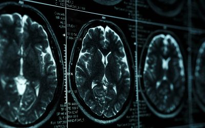 Your Brain on Screens, Revenge, and Addiction