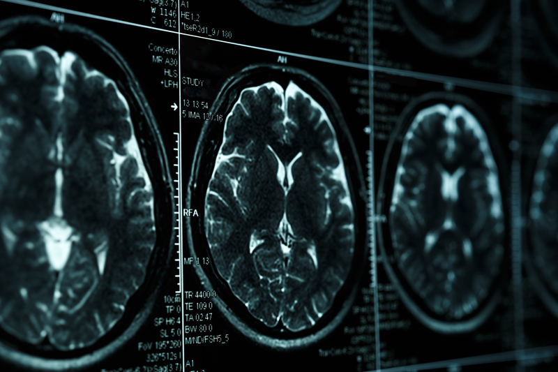 Your Brain on Screens, Revenge, and Addiction